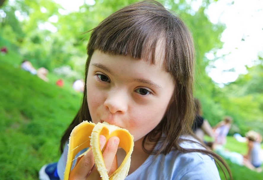 A young girl with disability standing in a park eating a banana.